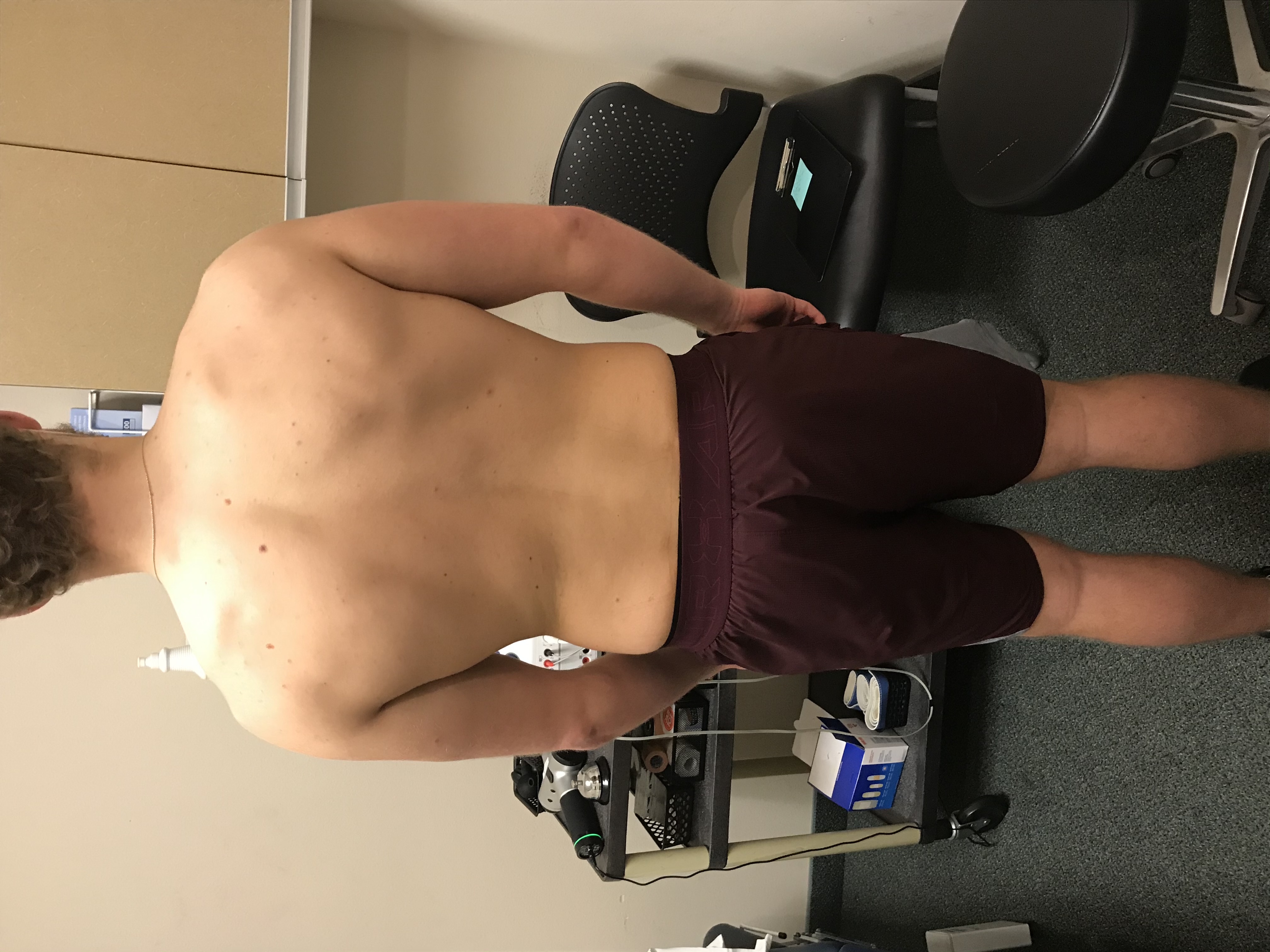 Max before recovery