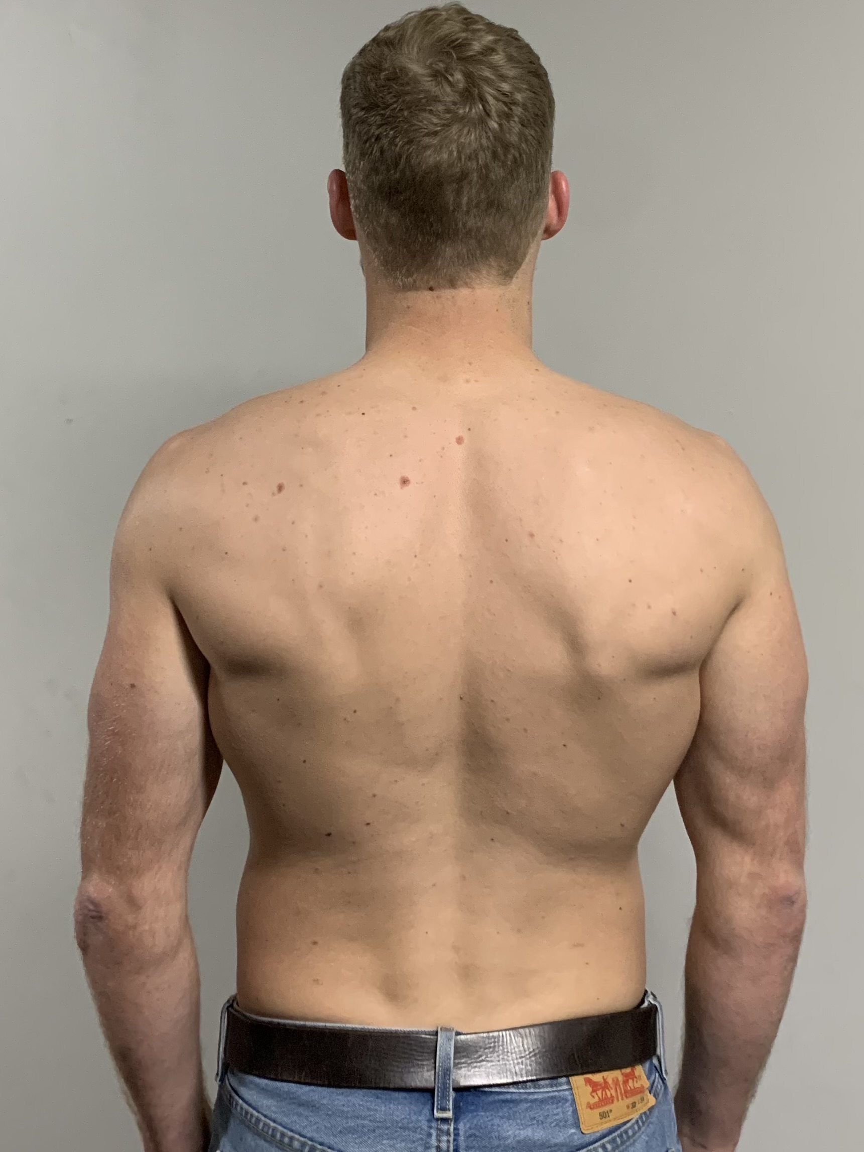 Max after recovery